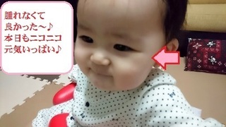 あまり腫れなった♪ (400x225).jpg