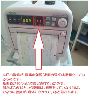 陣痛の強弱.png
